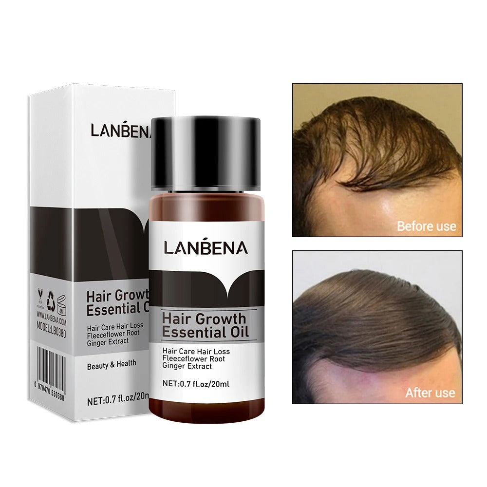 LANBENA Best Hair Growth Essential Oil Hair Loss Treatment Hair Thickening Nourishing Care Serum