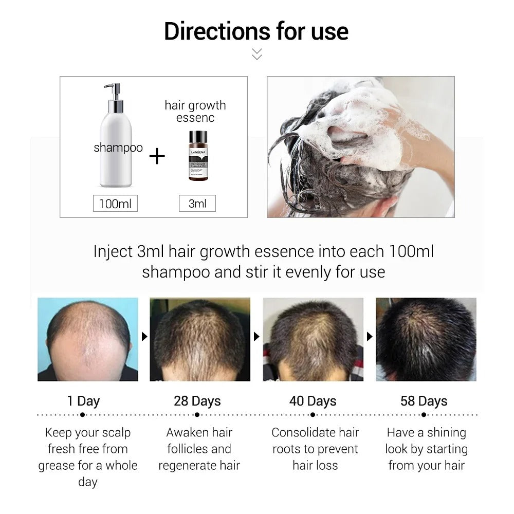 LANBENA Best  Hair Growth Essential Oil Hair Loss Treatment Hair Thickening Nourishing Care Serum