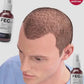 FEG Plus Hair Growth Spray